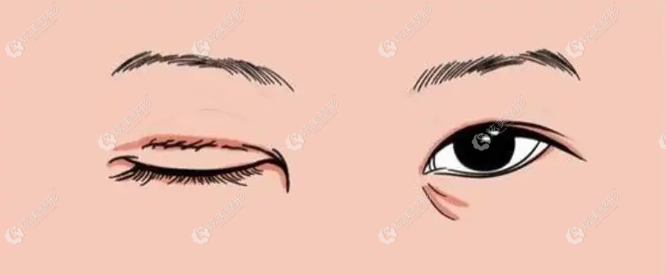 ��������˫��Ƥ�޸�����