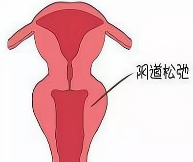 Ӧ�Խ���