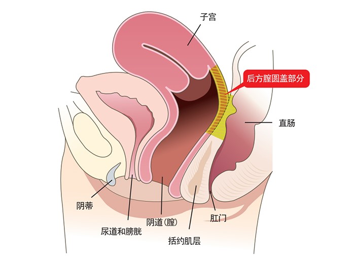 五、紧缩手术潜在风险