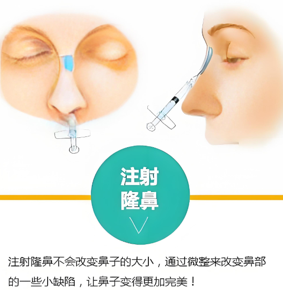 大连隆鼻多少钱?4家医院热门项目参考价对比