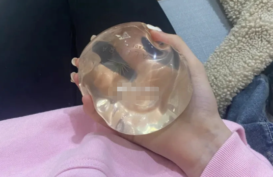 四、胸部双环悬吊价格贵吗?不同情况费用差多少?