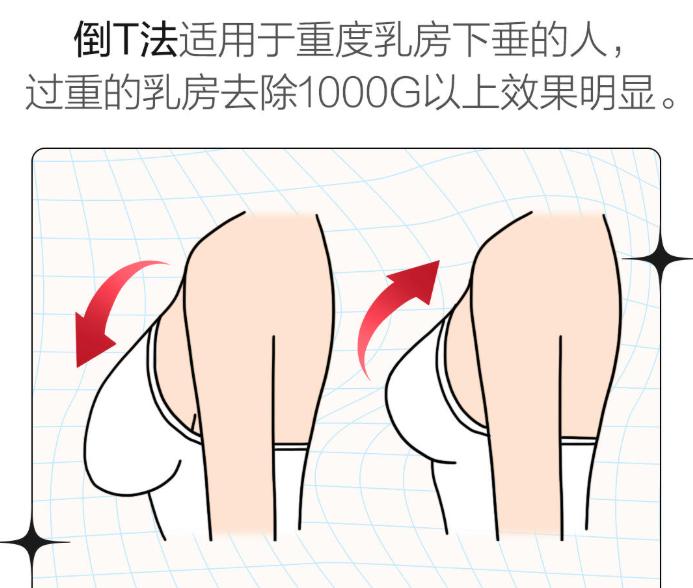 ����������������Ǯ���Ƽ�10��˽��ҽԺ���������ǻ����۸�͸�����ȿ�