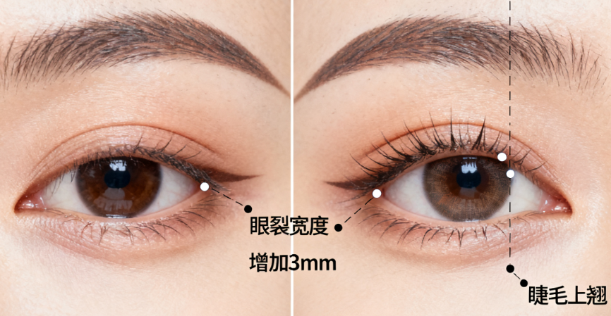 一、 深度解析:上海安禾美阁哪个医生双眼皮做的好?看郑小红与王小桃的技术博弈
