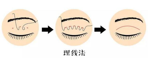 五、 真实感言:老粉丝眼里的安禾美阁医生