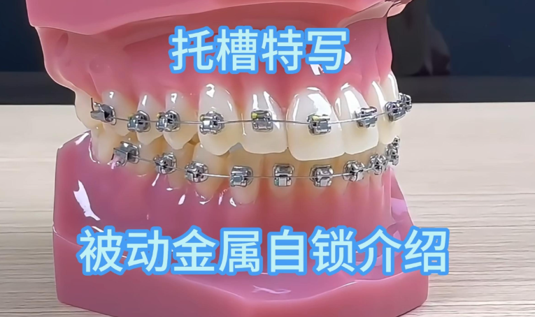 �뵺��ʱ��ͻƽ�΢��5���ĸ��ã�һ�仰��Ҫ����ѡ��ʱ�룬��ë��ѡ��΢